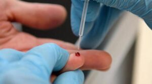 Test sierologici, scoppia il caos dopo alcuni risultati positivi