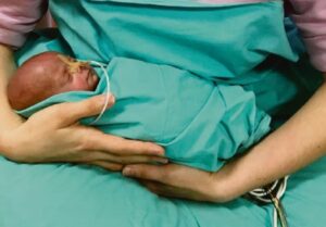 La prima foto con la figlia che quand’è nata pesava 600 grammi