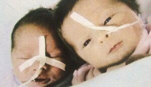 «La mia storia di mamma di gemelli nati prematuri tra mille imprevisti»